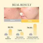 Medicube Jelly Gel Mask with Brightening Kojic Acid Turmeric | Overnight Face Ma