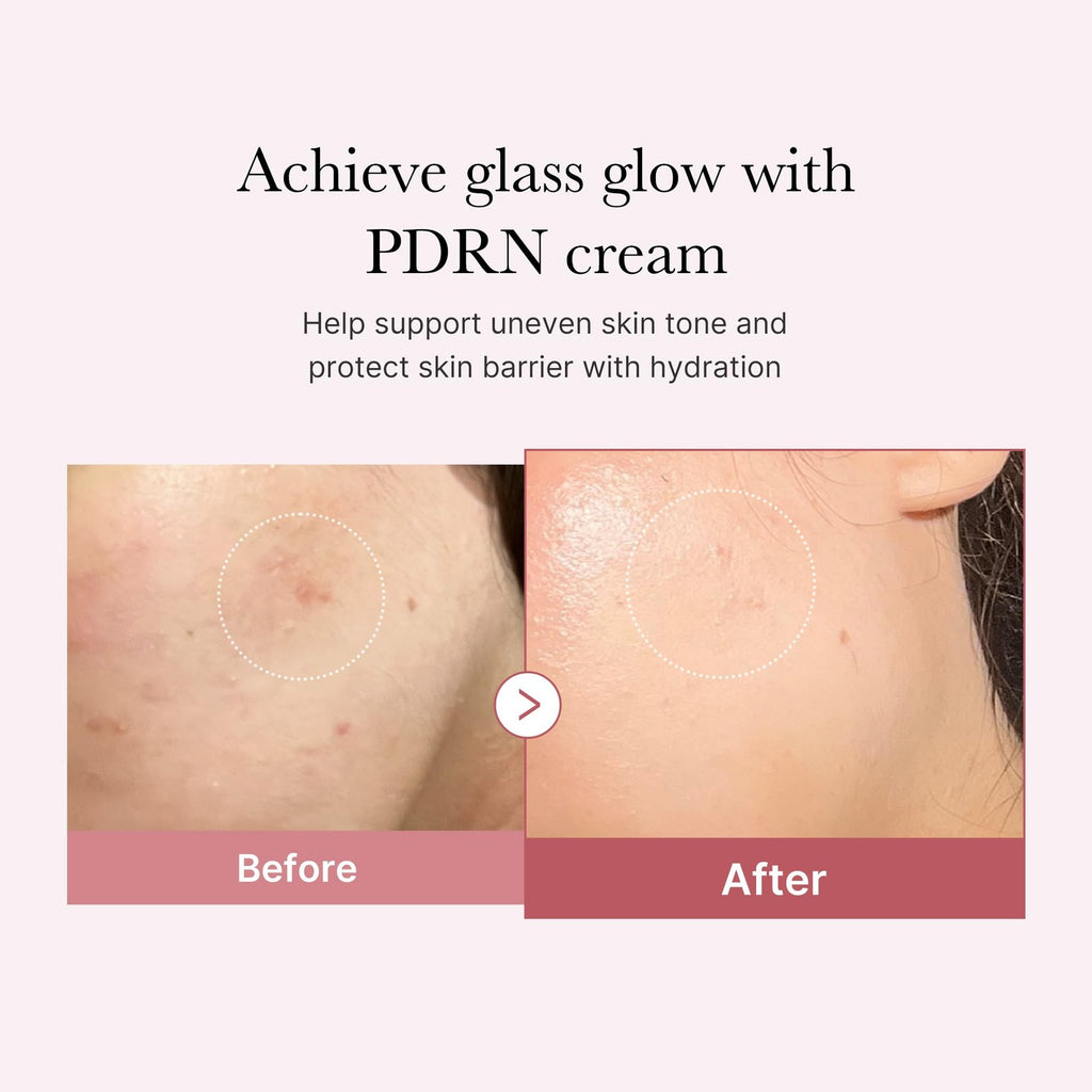 Medicube PDRN Pink Hyaluronic Moisturizing Cream | Blemish Recovery, Relief &...