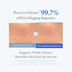 Medicube Zero Pore Clearing Capsule Cleansing Foam 120G-Pore Deep Cleansing